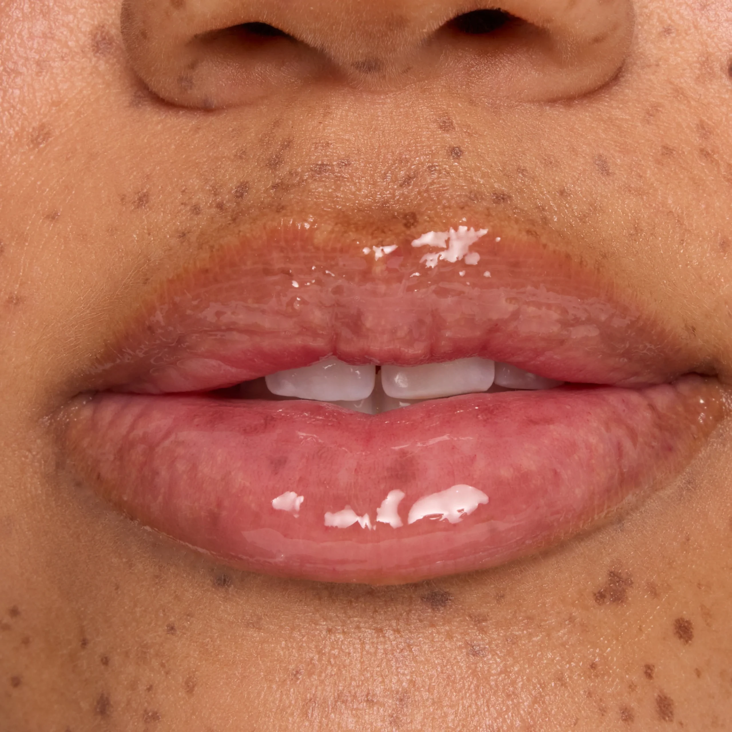 Candy Cane - Image 4